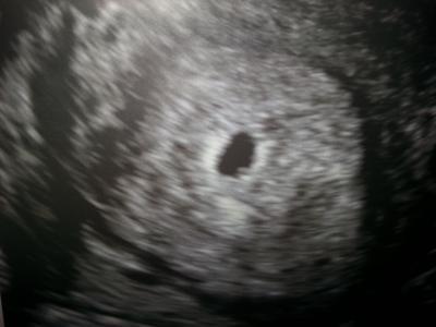 Bild zu Auch zurück vom Fa :) - Forum für August - Mamis
