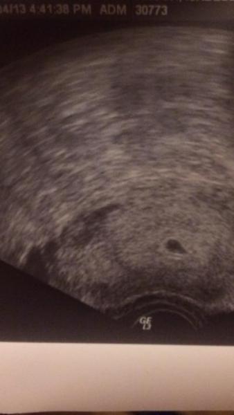 Bild zu Hallo Mädels:D - Forum für August - Mamis