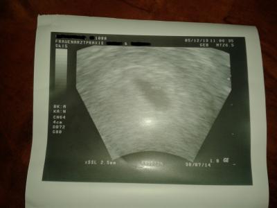 Bild zu Wieder zurück vom FA ... - Forum für August - Mamis
