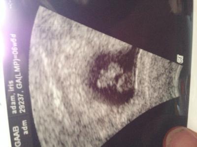 Bild zu Vom fa zurück :) - Forum für August - Mamis