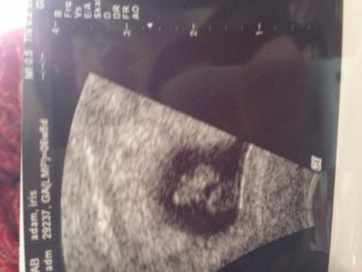 Bild zu Weiter als 6+4? - Forum für August - Mamis