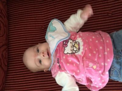 Bild zu Storchenbisse - Forum für August - Mamis