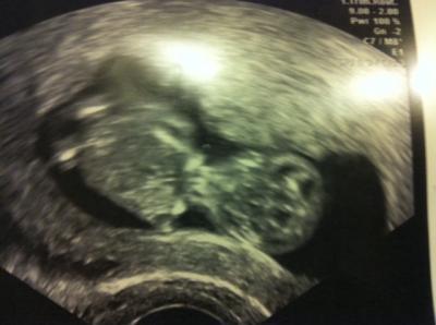 Bild zu Unser neuestes Passbild - Forum für August - Mamis