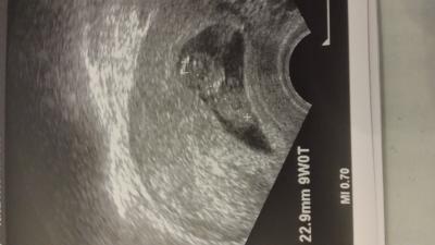 Bild zu zurück vom FA.. - Forum für August - Mamis