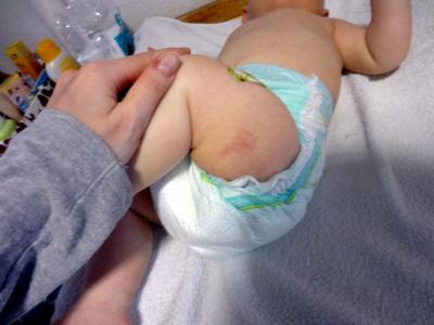 Bild zu weiß jemand, was das ist? - Forum für August - Mamis