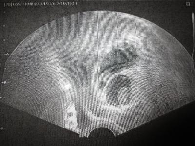 Bild zu Zurück vom Ultraschall - Es sind zweieiige Zwillinge :-) - Forum für August - Mamis