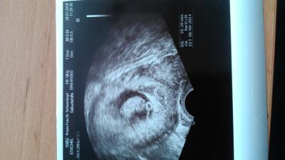 Bild zu Gestern FA-Termin :-) - Forum für August - Mamis