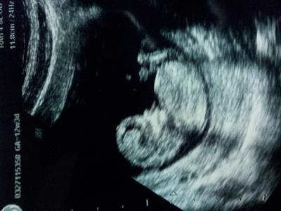 Bild zu 1. erkennbarer US - Forum für August - Mamis