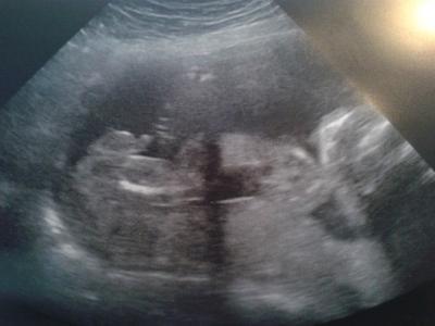 Bild zu Möchte mich auch noch zu Euch gesellen.... gleich mit Outingfoto. - Forum für August - Mamis