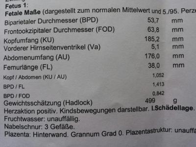 Bild zu Bericht Zwillingsspezialist - Forum für August - Mamis