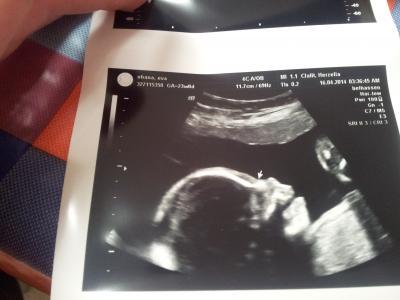 Bild zu 2. großer US - Forum für August - Mamis
