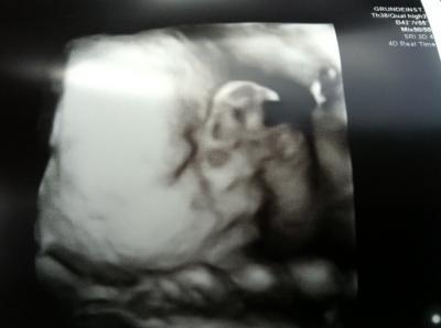Bild zu Unser kleines Mädchen - 4 D - Forum für August - Mamis