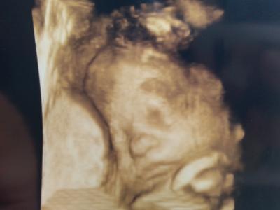 Bild zu 3D bildchen von unserem prinzen - Forum für August - Mamis