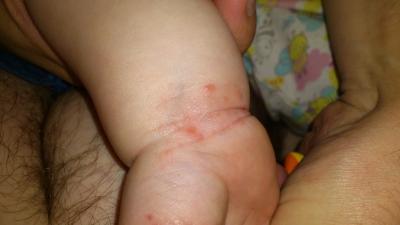 Bild zu Allergie oder was könnte es sein.? - Forum für August - Mamis