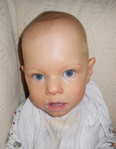 Bild zu Fontanelle - Forum für August - Mamis