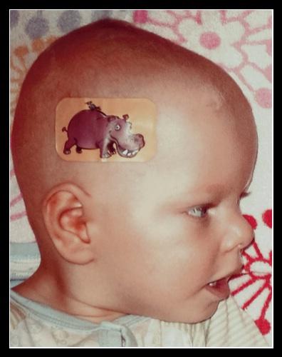 Bild zu Pflaster abkriegen....wie??? - Forum für August - Mamis