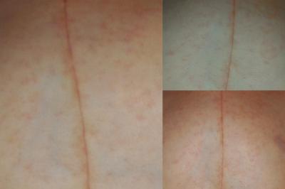 Bild zu was könnte das sein? - Forum für August - Mamis