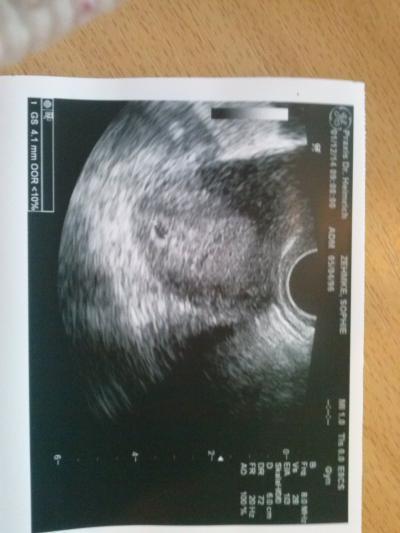 Bild zu 4,1mm - Forum für August - Mamis