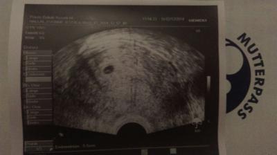 Bild zu bald zweifach mama :) - Forum für August - Mamis