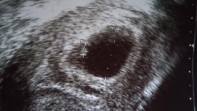 Bild zu Termin überstanden - Forum für August - Mamis