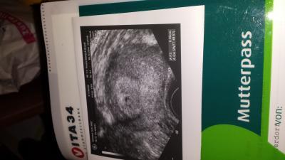 Bild zu das ist unser pünktchen - Forum für August - Mamis