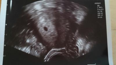 Bild zu Mein Würmchen - Forum für August - Mamis