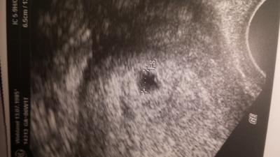 Bild zu so jetzt nochmal maße und foto - Forum für August - Mamis