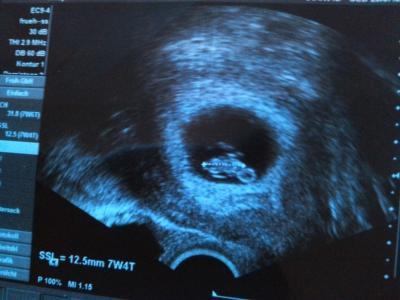 Bild zu US-Termin - Forum für August - Mamis