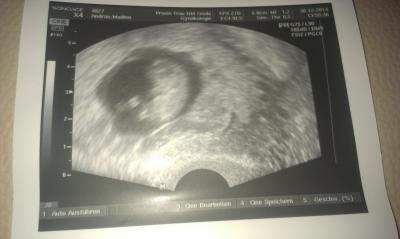 Bild zu 2. FA Termin - Forum für August - Mamis