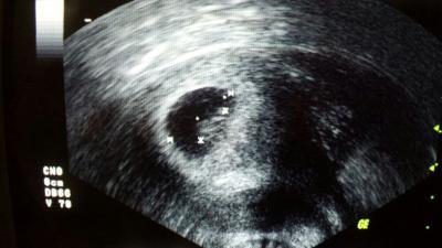 Bild zu 2. FA-Termin - Forum für August - Mamis