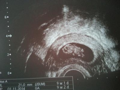 Bild zu 1. US - Forum für August - Mamis