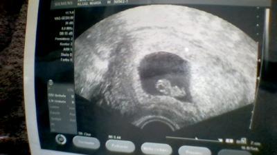 Bild zu unser muckelchen - Forum für August - Mamis