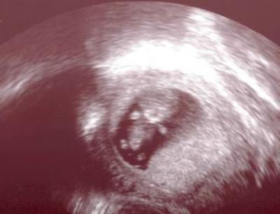 Bild zu Auch Termin gehabt - Forum für August - Mamis