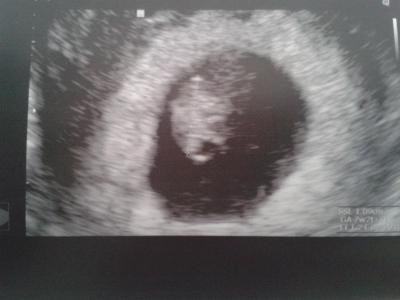 Bild zu Kügelchen gehts gut, so erleichtert - Forum für August - Mamis