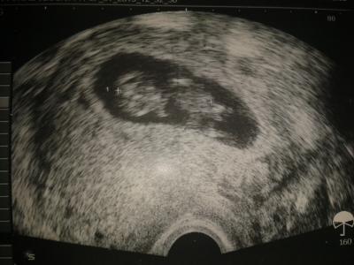 Bild zu alles super - Forum für August - Mamis