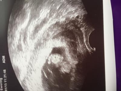 Bild zu Sooo dann kann ich unser knubbelchen auch zeigen :) - Forum für August - Mamis