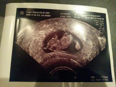 Bild zu Geburtsvorbereitungskurs beim 2. Baby und ein Bild unseres Gummibärchens :-) - Forum für August - Mamis