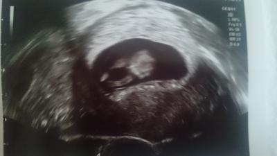 Bild zu 3. US heute *__* - Forum für August - Mamis