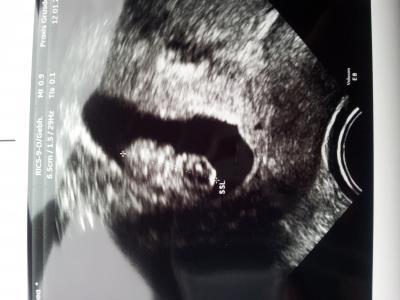 Bild zu 1. offizieller Ultraschall :-) - Forum für August - Mamis