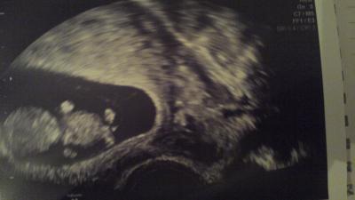 Bild zu Huhu - Forum für August - Mamis