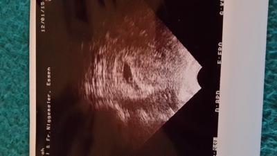 Bild zu Bin neu hier - Forum für August - Mamis