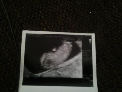 Bild zu 1.Screening endlich!! - Forum für August - Mamis