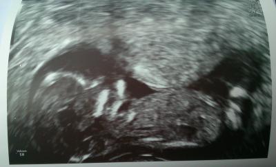 Bild zu Soooooooooooo verliebt !!! - Forum für August - Mamis