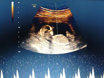 Bild zu zurück von der nfm - Forum für August - Mamis