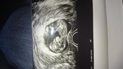 Bild zu FA-Termin :-) - Forum für August - Mamis