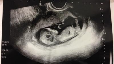 Bild zu Hallo 13te Woche - Forum für August - Mamis