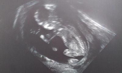 Bild zu Große Erleichterung nach gestrigem FA-Termin - Forum für August - Mamis