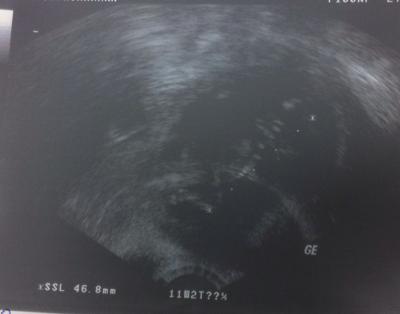 Bild zu Glücklich - Forum für August - Mamis