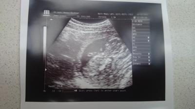 Bild zu Umzug und 1. FA Termin in neuer Stadt :/ - Forum für August - Mamis