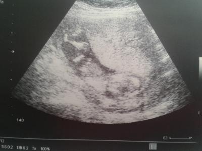 Bild zu zurück vom Frauenarzt - Forum für August - Mamis